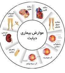 پاورپوینت با عنوان دیابت,طبقه بندی دیابت,عوارض دیابت و درمان دیابت